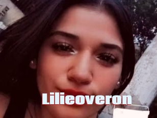 lilieoveron Anal Open