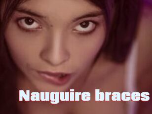 Nauguire_braces
